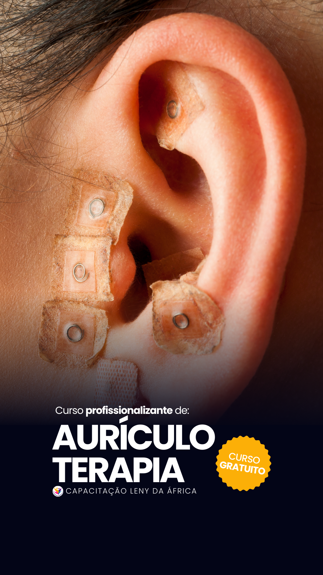 Auriculoterapia